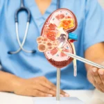 chronic disease management plan